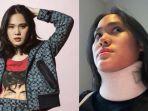 sheryl-sheinafia-jatuh-sakit-hingga-harus-pakai-penyangga-leher.jpg