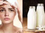 susu-beruang-punya-manfaat-untuk-mengatasi-wajah-berjerawat-ilustrasi-3r.jpg