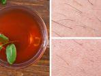 teh-spearmint-untuk-menipiskan-rambut-di-tubuh.jpg