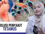 tetanus-cara-mengobati.jpg