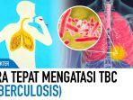 tips-ampuh-atasi-TBC.jpg