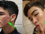 transformasi-carlos-david_20180211_184907.jpg