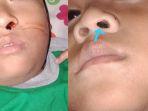 viral-anak-di-solo-hidung-mimisan-tiap-hari-selama-sebulan-benda-mirip-agar-agar-jadi-penyebabnya.jpg