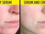 wajah-breakout-pakai-serum.jpg
