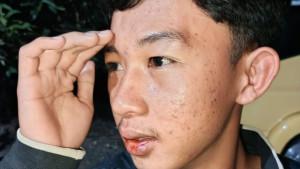 Korban-pengeroyokan-Ari-Wijaya-mengalami-luka-di-wajah-dan-bibir-usai-dipukul.jpg