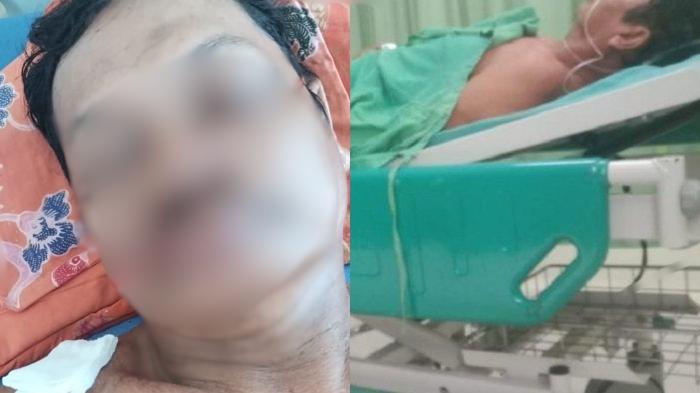 Pelaku Penganiayaan Warga Mamuju Tengah Dituntut 2 Tahun Penjara, Keluarga Korban: Kami Kecewa
