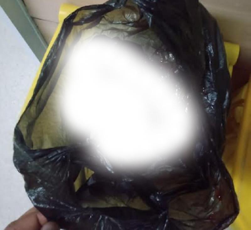 BREAKING NEWS: Warga Simboro Temukan Bayi Dalam Kantong Plastik Hitam, Kondisi Masih Hidup