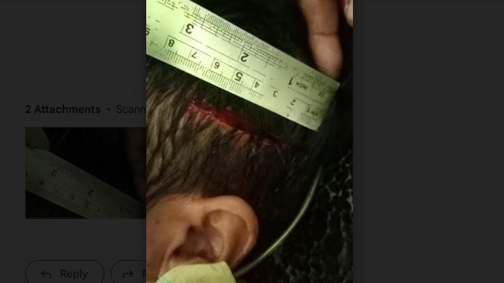 BREAKING NEWS: Pria di Tommo Mamuju Bacok Ipar Gegara Anak Menangis