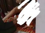 Kondisi-korban-kebakara-Ibnu-3-sata-dirawat-di-RS-Bhayangakra-Mamuju-Jl-Arteri-Mamuju-Sulbar.jpg