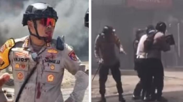 LUKA KAPOLRESTA KENDARI - Kolase foto Kepala Kepolisian Resor Kota atau Kapolresta Kendari, Kombes Pol Edwin Louis Sengka, diobati usai terluka terkena lemparan batu dalam pengamanan aksi blokade jalan berujung ricuh di Perempatan Wua-Wua, Kota Kendari, Sulawesi Tenggara (Sultra), pada Kamis (20/11/2025) (foto kiri). Kapolresta Kendari Kombes Edwin menceritakan kronologi terkena lemparan batu saat memimpin apel pembubaran pasukan setelah situasi kondusif di lapanagan kantor TVRI Sultra (foto kanan). Aksi tersebut menyebabkan akses jalan di perempatan Jalan Ahmad Yani, Jalan Budi Utomo, dan Jalan Imam Bonjol, Kelurahan Kadia, Kecamatan Wua-Wua, lumpuh total. (Istimewa/TribunnewsSultra.com-Sugi Hartono)