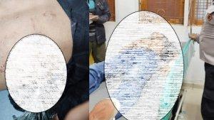kondisi-mahasiswa-yang-terkena-busur-saat-hendak-keluar-membeli-rokok-disalah-satu-warung.jpg