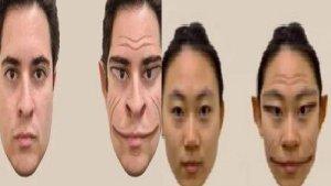 viral-cerita-seorang-warga-di-Amerika-Serikat-alami-sindrom-wajah-iblis.jpg