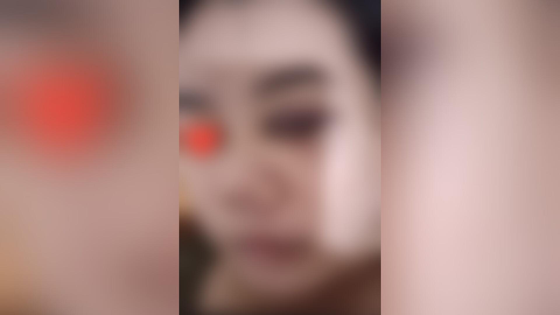 Dianiaya-Mantan-Suami-Wanita-di-Kendari-Sempat-Tak-Bisa-Melihat-Harap-Polisi-Segera-Tangkap-Pelaku.jpg