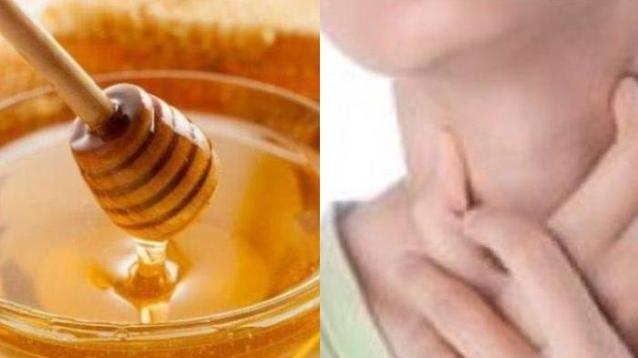 Simak Kandungan dan Manfaat Madu yang Efektif sebagai Obat Sakit Tenggorokan Alami