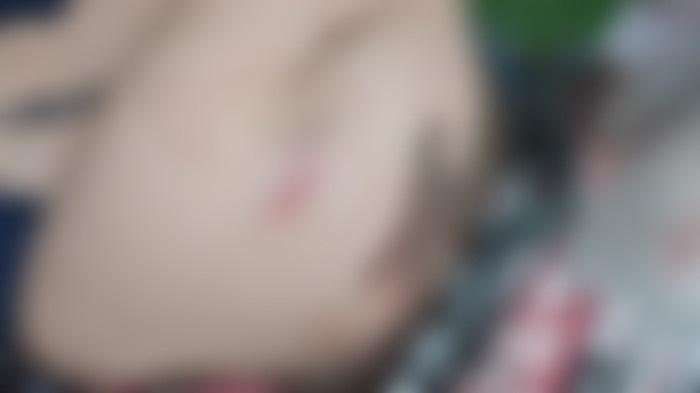 Polisi Benarkan Seorang Wanita di Kendari Ditikam Orang Tak Dikenal Saat Berkendara