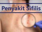 penyebab-sifilis-atau-penyakit-raja-singa-gejala-pengobatan-pencegahan.jpg