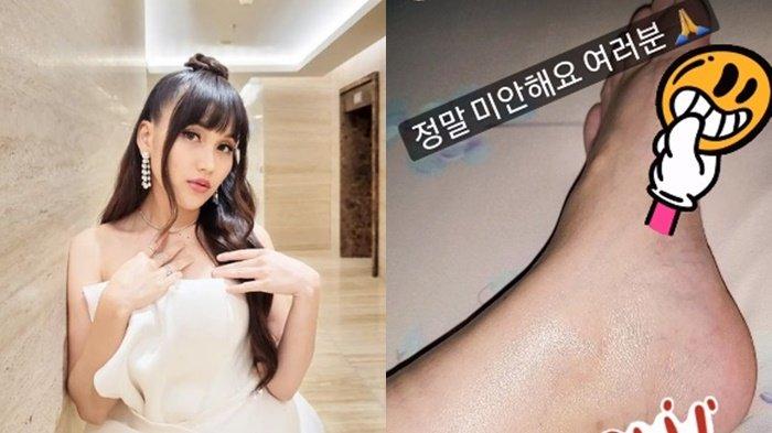 Kondisi Ayu Ting Ting Usai Jatuh di Panggung HUT Indosiar, Kaki Jadi Bengkak, Sampaikan Maaf