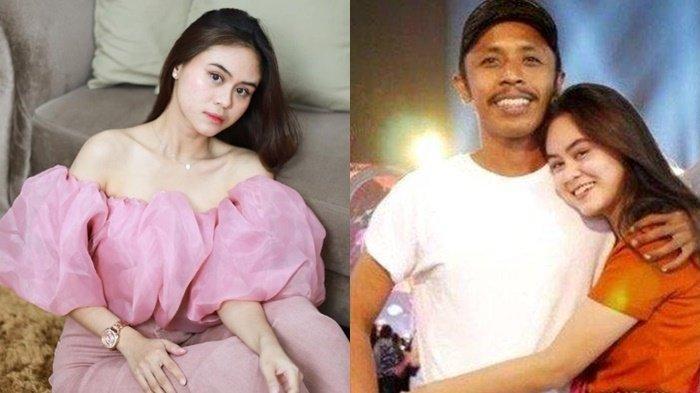 Dwinda Eks Istri Furry Setya Marah Dituding Minta Mantan Suami Samai Raffi Ahmad : Tolong Bedakan