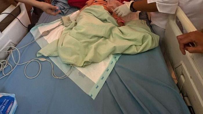 Ka dirawat di rumah sakit karena cacing menggumpal