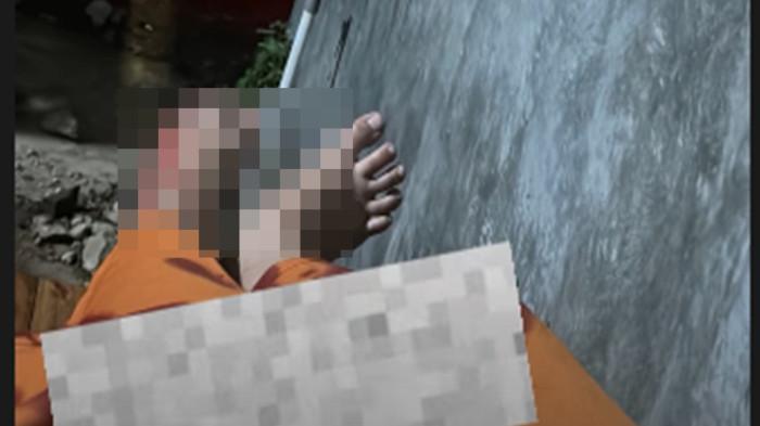 Kondisi kaki Cantika Davinca usai alami kecelakaan yang tewaskan 2 orang.