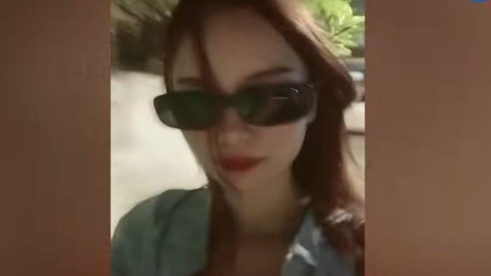 KORBAN BEGAL- Model blasteran Indonesia-Belanda, Ansy Jan De Vries, dikabarkan menjadi korban begal dan pembacokan di wilayah Kebon Jeruk, Jakarta Barat, pada Sabtu (16/5/2026) dini hari.