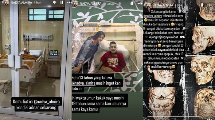 TABRAK LARI- Nadya Almira dituding tidak bertanggung jawab oleh keluarga Adnan, yang merupakan korban tabrak lari sejak 13 tahun silam, korban alami kista otak dan masih kritis.