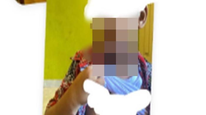 Viral Siswa SDN 150 Palembang Diduga Dibully, Tubuh Melepuh Gegara Air Panas, Respons Guru Disorot