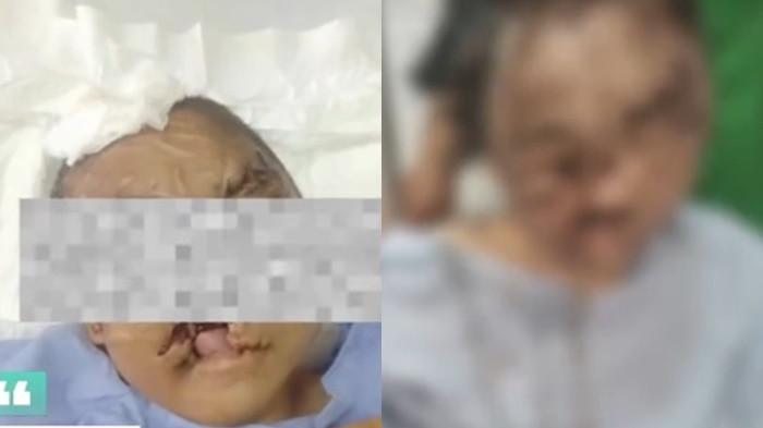 PENYEKAPAN -- Sosok YTR (29) merupakan karyawati swasta asal Rancaekek yang sempat dimutasi kerja ke Pasteur hingga Majalengka sebelum hilang kontak.