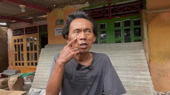 PENJUAL ES KUE DIFITNAH - Suderajat, penjual es kue yang difitnah oleh oknum aparat menunjukan sejumlah luka bekas penganiayaan yang dialaminya, Selasa (27/1/2026). Selain difitnah Suderajat mengaku dianiaya oknum aparat.