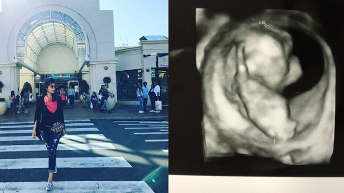 6 Tahun Sembunyikan Identitas Suami, Artis Cantik Ini Malah Umumkan Kehamilan