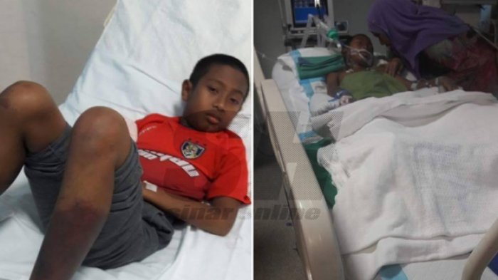 Bocah yang Ingin Jadi Penghafal Alquran Harus Kehilangan Kakinya Gara-gara Pria Kejam ini