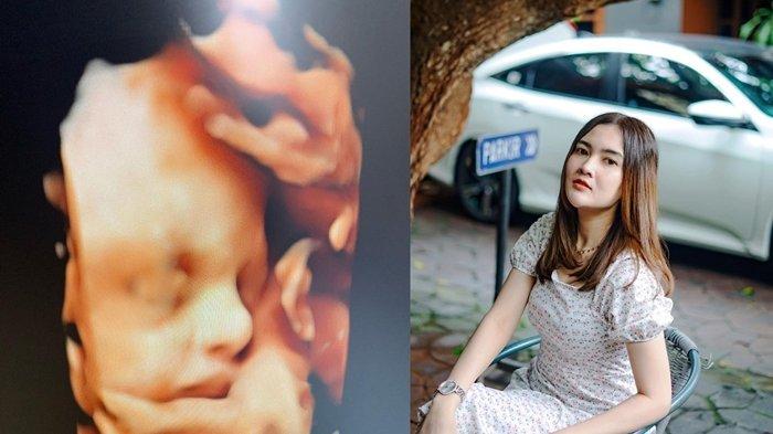 Lama Tak Ada Kabar, Unggahan Nella Kharisma Jadi Sorotan, Ternyata Ini Penyebabnya