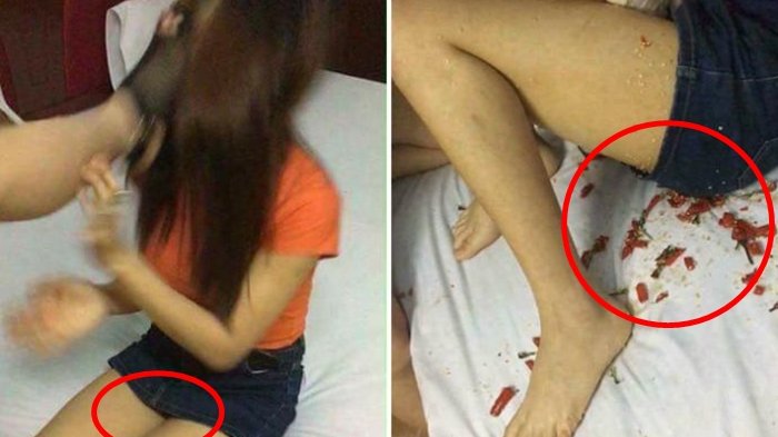 Mengerikan! Sakit Hati Diselingkuhi, Suami Masukan Benda Ini ke Kemaluan Istrinya