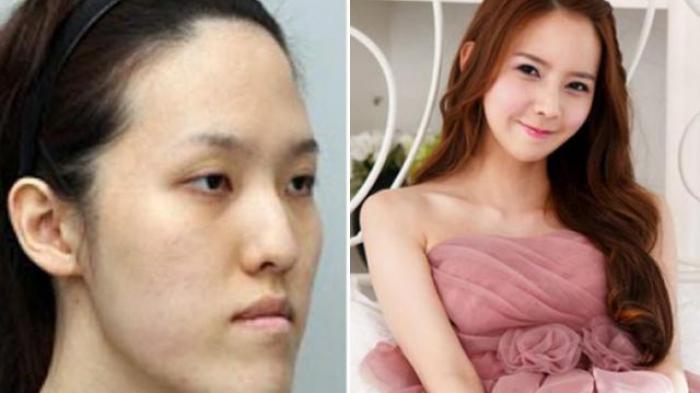Dulu Dibully Karena Jelek, Wanita Ini Sekarang Berubah Bak Artis Korea