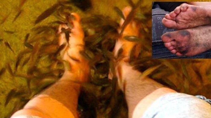 Ketika Lakukan Spa Ikan, Semua Ikan Mati Karena Kaki Pria Ini Sangat Bau, Pemilik Spa pun Merugi
