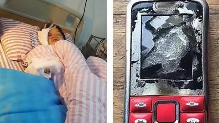 Bocah Ini Main HP Saat Sedang Di-Charge, Ini Nasib Mengerikan yang diterimanya