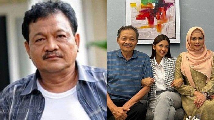 Penyebab Eeng Saptahadi Meninggal Dunia di Usia 65 Tahun, Sempat Dilarikan ke RS Terpapar Covid