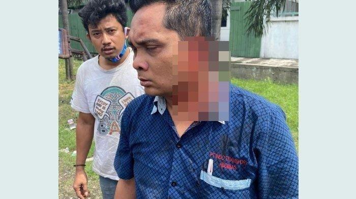 NGERI, Telinga Kondektur Bus Putus Digigit Pengendara Motor, Kesal Tak Diberi Celah untuk Menyalip