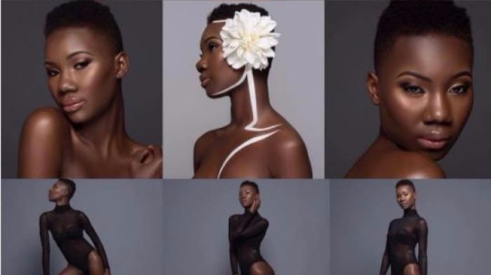 Dibully Karena Warna Kulit, Tak Disangka Perubahan Wanita Ini Sekarang Bikin Melongo