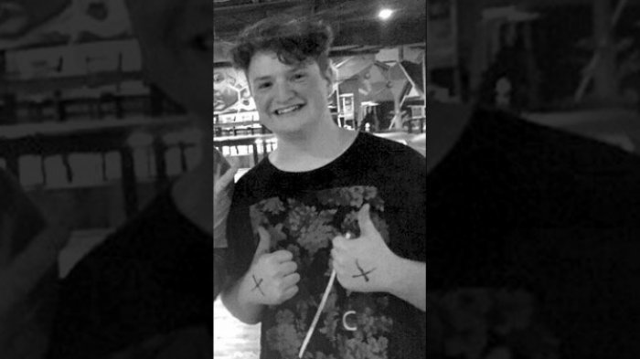 Jangan Minum ini Setelah Minum Kopi Jika Tak Mau Bernasib Seperti Wanita ini, Mengerikan