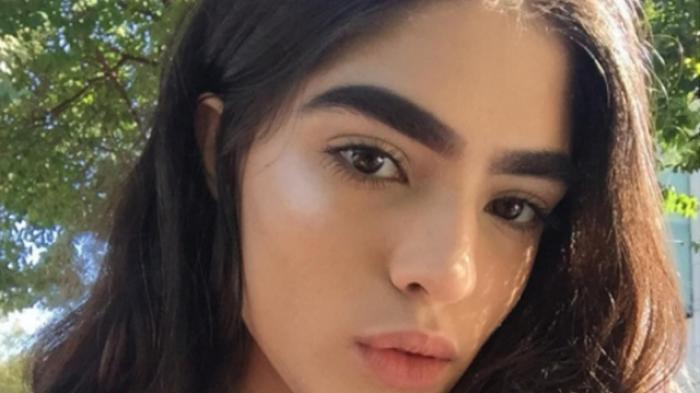 Sering Dihina Karena Alisnya, Sekarang Ia Menutup Mulut Semuanya dengan Ini