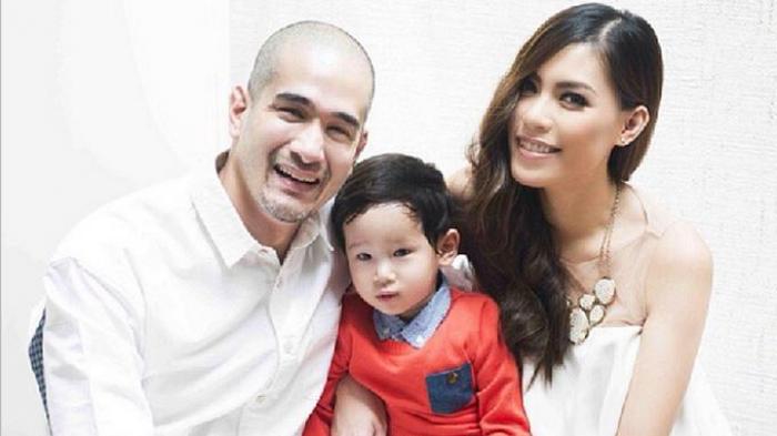 Akui Jalani Sedot Lemak, Okan Kornelius Rasakan Hal Ini. Sehat Dapet, Pede Dapet