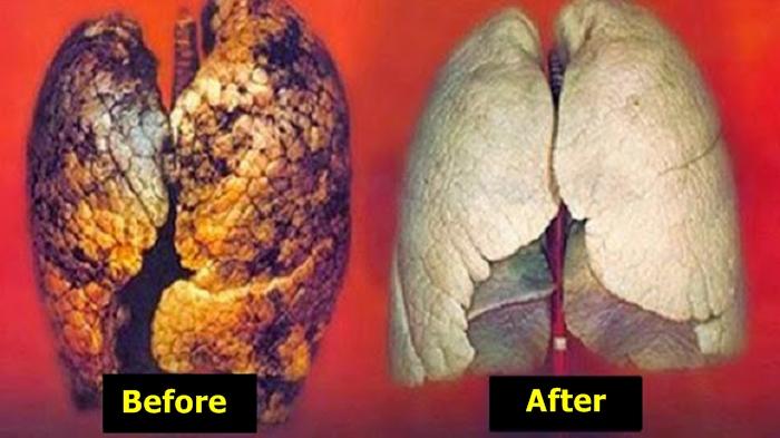 Ini Cara Membersihkan Paru-paru Dalam Waktu 3 Hari