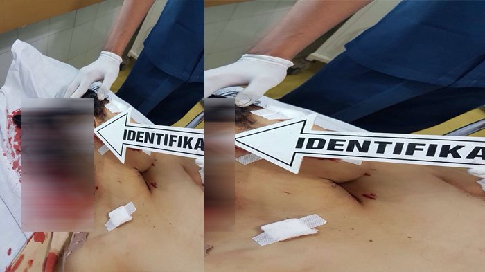 Dengar Suara Ribut di Luar Rumah Saat Dilihat Ternyata Pemandangan Mengerikan Bersimbah Darah