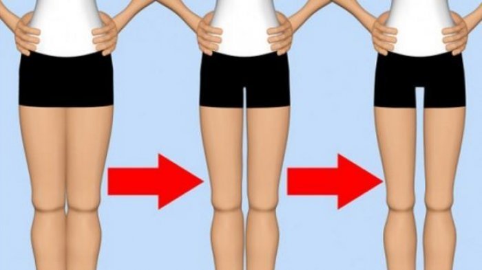 Mitos Atau Fakta Jika Keperawanan Bisa Diketahui dari Cara Jalan? Begini Penjelasan Dokter Spesialis