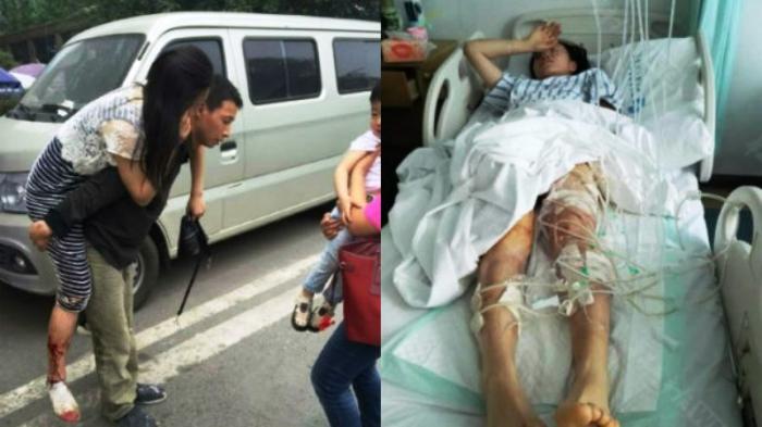 Lindungi Anak, Ibu Ini Rela Bertarung dengan Anjing Besar