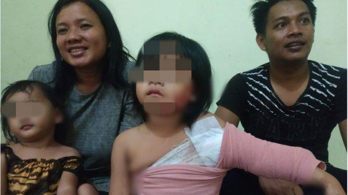 Kisah Perjuangan Bocah 5 tahun Tersiram Minyak Panas saat Beli Sosis, Luka Bakar 63 Persen