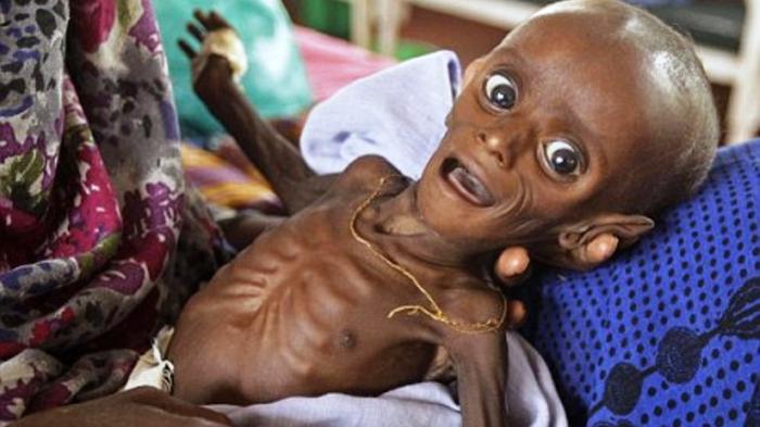 Restoran Ini Pajang Foto Kelaparan Agar Pengunjung Tidak Serakah