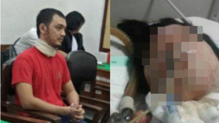 Tak Mau Putus, Pria di Medan Nekat Bakar Kekasih yang Sudah Dipacarinya Selama 6,5 Tahun