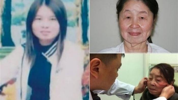 Viral Wajah Wanita Ini Berubah Keriput Dalam Semalam, Padahal Usianya Baru 27 Tahun, Ini Penyebabnya